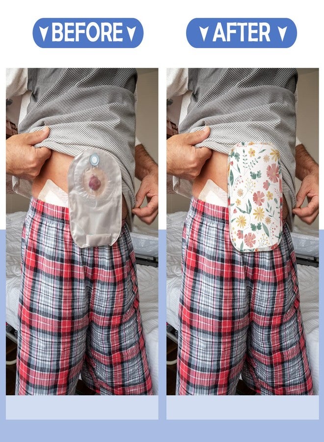 Sosation 6 Pieces Ostomy Bag Covers Waterproof Ostomy Shower Cover Lightweight Colostomy Bags Covers Shower Wraps with Opening for Women Men Ileostomy Care Protector Odor Reducing Supplies - Image 4